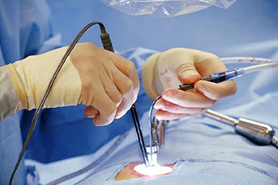 Minimally Invasive Spine Surgery