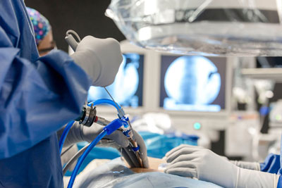 Minimally Invasive Spine Surgery