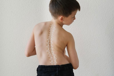 Minimally Invasive Spine Surgery